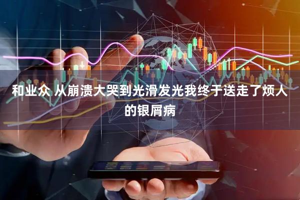 和业众 从崩溃大哭到光滑发光我终于送走了烦人的银屑病